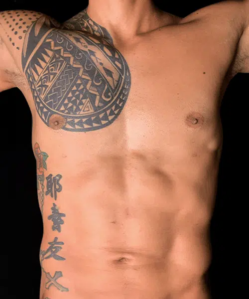 Marcación abdominal despues