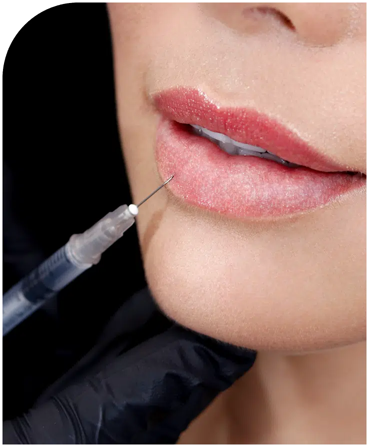 Redefinición de labios